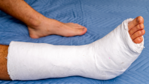 Injuries Often Seen in a Northwest Las Vegas Truck Collision